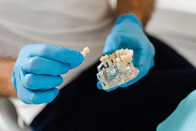 doctor holding a model of a dental implant