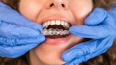 dental assistant placing Invisalign braces on patient